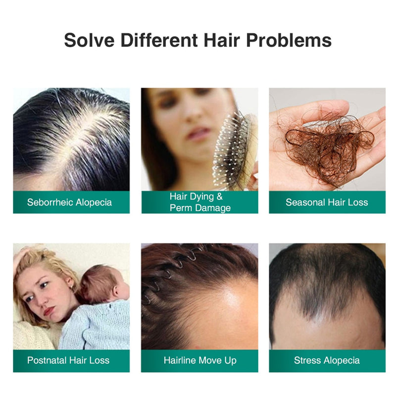 Ginger Hair Growth Spray Essential Oil